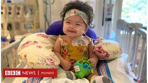 Niña recibe el corazón de un niño de 4 años en el primer trasplante de este tipo en Ucrania